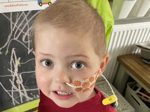 A young boy with short blonde hair is smiling and has a nasogastric tube fitted while wearing a red top.