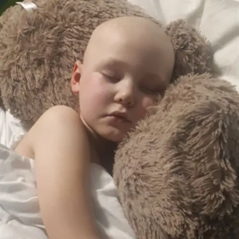 A young boy with a bald head is sleeping in bed with his head resting on a large, soft teddy bear.