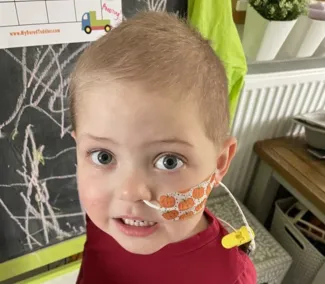 A young boy with short blonde hair is smiling and has a nasogastric tube fitted while wearing a red top.