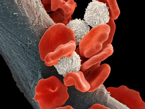 Flattened red blood cells shown with round white blood cells.