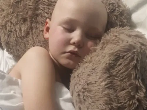 A young boy with a bald head is sleeping in bed with his head resting on a large, soft teddy bear.