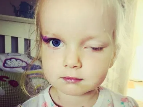 A young girl with one eye closed, wearing white pyjamas with a flower pattern.