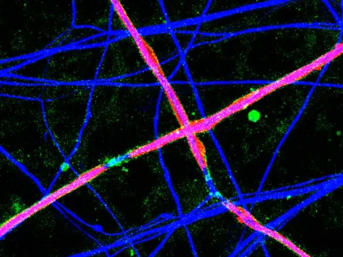 A fluorescently tagged microscope image of nerve cells.