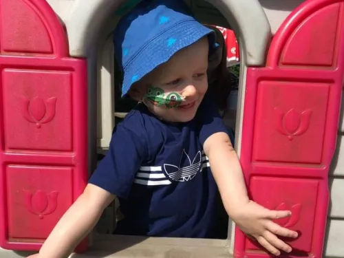 A young boy with a nasogastric tube is wearing a blue hat while leaning out of a plastic playhouse window.